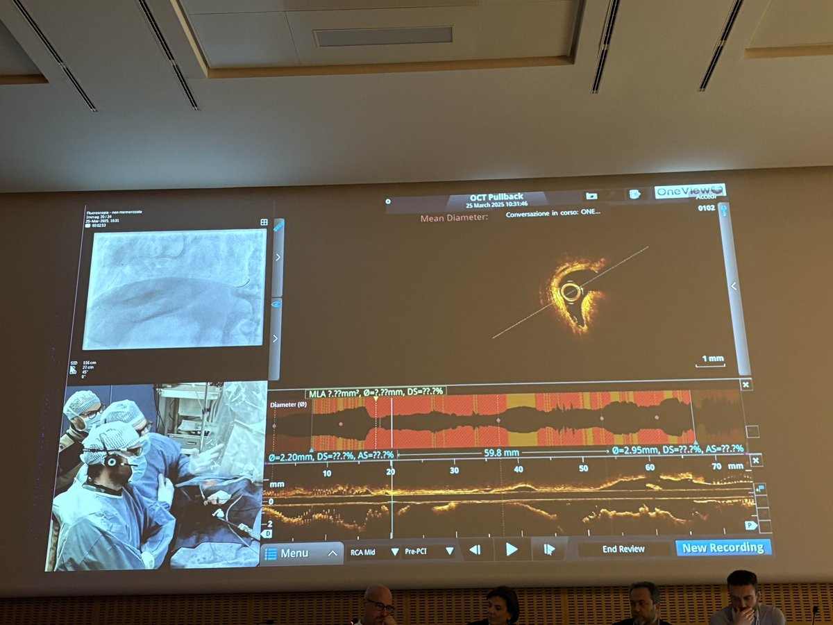 Marta Herrero (@martahb5) on Twitter photo Had the pleasure of participating as a panelist in the “Rock&Talk: Imaging and Calcium” course in Milan. Thanks to Dr. Gasparini, Dr. Regazzoli and Dr. Mangieri for organizing and including me. Great live cases also by Dr. Canova, Dr. Ugo and Dr. Oreglia. A rewarding experience! Had the pleasure of participating as a panelist in the “Rock&Talk: Imaging and Calcium” course in Milan. Thanks to Dr. Gasparini, Dr. Regazzoli and Dr. Mangieri for organizing and including me. Great live cases also by Dr. Canova, Dr. Ugo and Dr. Oreglia. A rewarding experience!