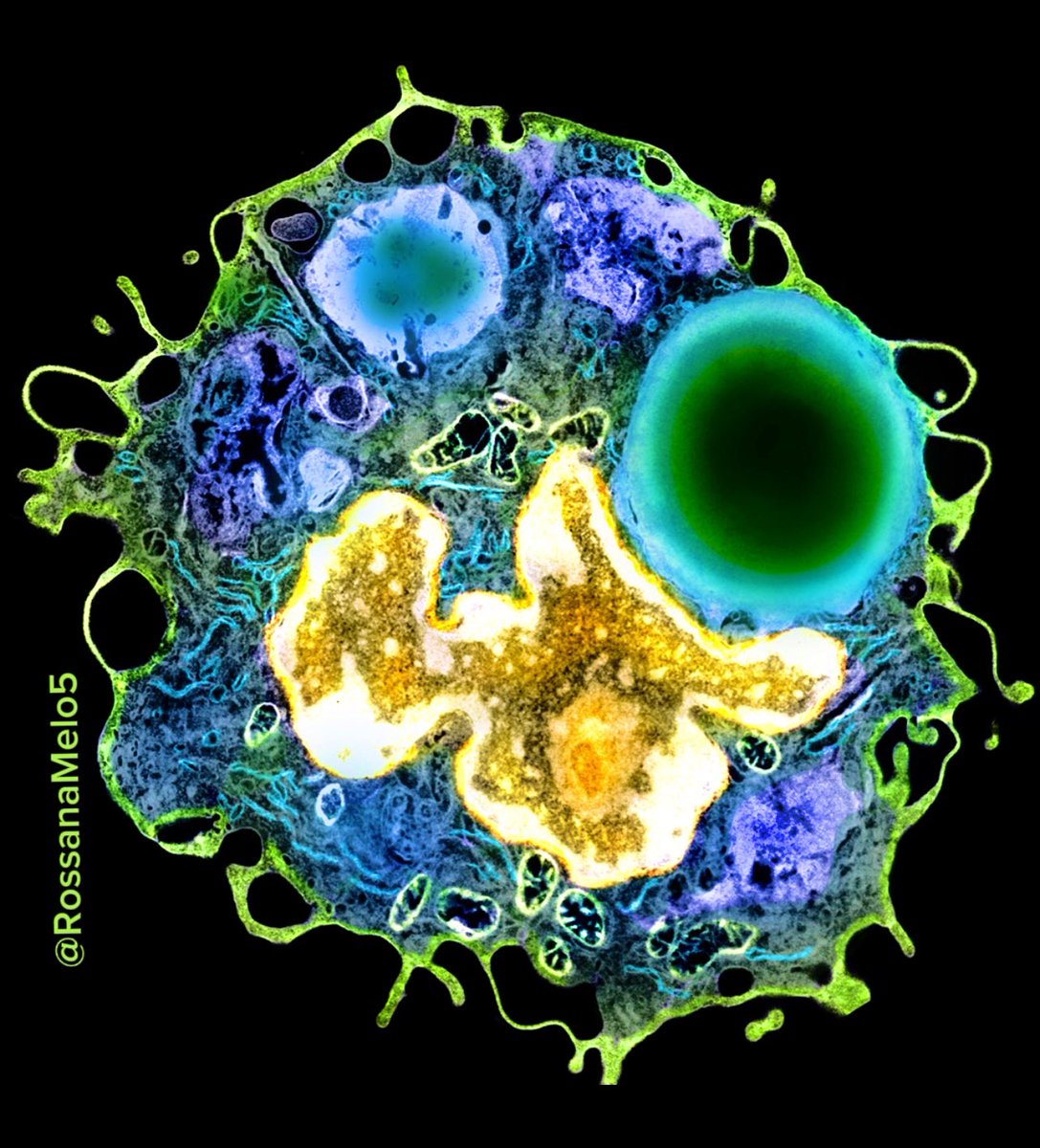 Starting the week strong with this powerful #macrophage full of phagosomes! 💪 #MicroscopyMonday  #electronmicroscopy #bioart