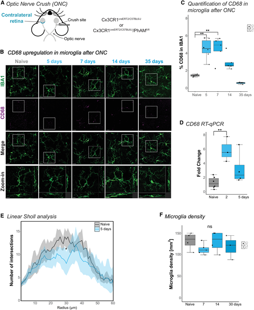 IOVS Journal (@arvoiovs) on Twitter photo Sandra Siegert et al. <a href="/SiegertLab/">Sandra Siegert</a> <a href="/ISTAustria/">ISTAustria</a> report that Optic Nerve Crush Does Not Induce Retinal Ganglion Cell Loss in the Contralateral Eye, iovs.arvojournals.org/article.aspx?a…. Sandra Siegert et al. <a href="/SiegertLab/">Sandra Siegert</a> <a href="/ISTAustria/">ISTAustria</a> report that Optic Nerve Crush Does Not Induce Retinal Ganglion Cell Loss in the Contralateral Eye, iovs.arvojournals.org/article.aspx?a….