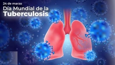 Día Mundial de la Tuberculosis. Cada 24 de marzo se acentúa la urgencia de poner fin a la TB, una de las enfermedades infecciosas más letales del mundo. Continuar investigando para su control y mejorar la calidad de vida de quienes la padecen es prioritario
<a href="/citmacuba/">Ministerio de Ciencia, Tecnología y Medio Ambiente</a> <a href="/MINSAPCuba/">Ministerio de Salud Pública de Cuba</a>