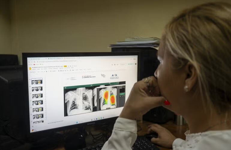 opsoms's tweet photo. 📣 Mientras los casos de #tuberculosis siguen aumentando en las Américas 🌎, las nuevas innovaciones prometen mejoras en el diagnóstico temprano y el tratamiento.
ℹ️ Lee más:
https://t.co/YFtbctGmaL
#FinALaTB https://t.co/g8ZIgiAmKY