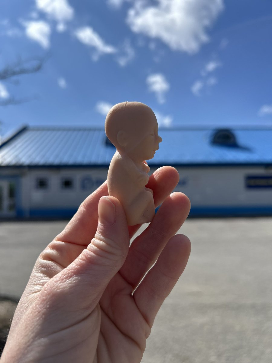 createdequalorg's tweet image. This is a life-size model of an 8-10 week old preborn baby. Babies this age are killed at abortion clinics across America every day. Pray to end abortion.

#endabortion #plannedparenthood #preborn