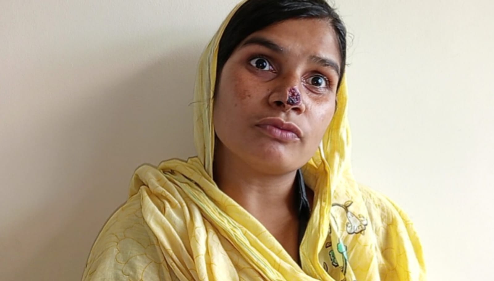 ঝগড়া হলেই কামড় দেয় লাকি আক্তার