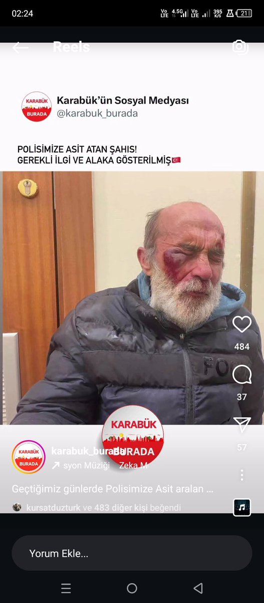 hicazdolap's tweet photo. @karabuk_burada isimli Instagram hesabı polisimize asit atan kişi başlığıyla bu fotoğrafı paylaşıyor.... Bu yalancı sahtekarlara Gerekeni yapmaz mıyız? @herkesicinCHP  @CHP_istanbulil @chpsafranbolugk @onedio https://t.co/BA1tEwFxUl