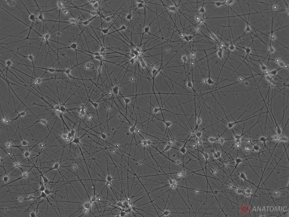 AnatomicTech's tweet image. 💎Check-out the purity💎 Images of RealDHN hiPSC-derived dorsal horn neuron cultures, generated without the need for genetic engineering or Mitomycin C treatment

Visit anatomic.com/realdhn for more info on the molecular and functional characterization of the neurons!