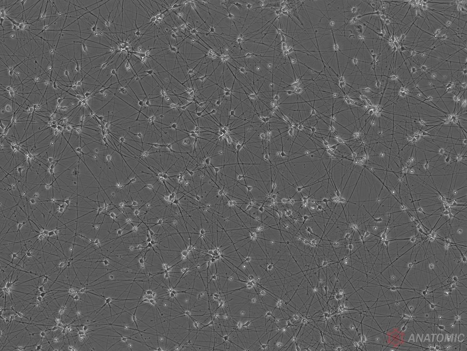 AnatomicTech's tweet image. 💎Check-out the purity💎 Images of RealDHN hiPSC-derived dorsal horn neuron cultures, generated without the need for genetic engineering or Mitomycin C treatment

Visit anatomic.com/realdhn for more info on the molecular and functional characterization of the neurons!
