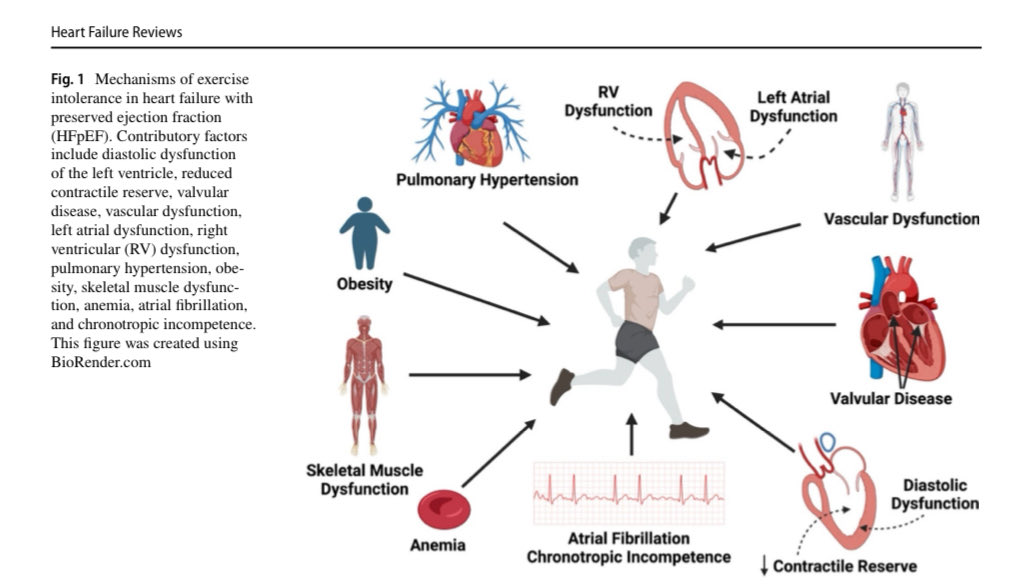 🔴 Mechanisms of exercise intolerance in HFpEF #Cardiology #CardioEd #Exercise