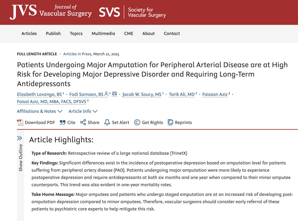 Faisal Aziz MD, MBA, FACS, Distinguished FSVS (@fa_vascularmd) on Twitter photo Patients undergoing major amputation for PAD face a significantly higher risk of depression.
<a href="/PennStVascular/">Penn State Vascular Surgery Residency</a> shows increased rates of antidepressant use and mortality post-op. Mental health support is critical. Patients undergoing major amputation for PAD face a significantly higher risk of depression.
<a href="/PennStVascular/">Penn State Vascular Surgery Residency</a> shows increased rates of antidepressant use and mortality post-op. Mental health support is critical.