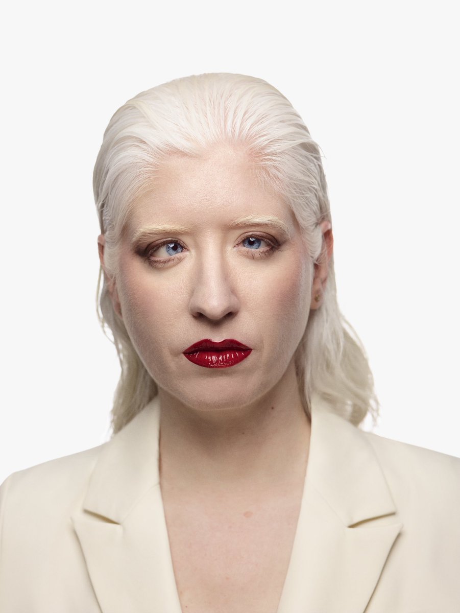 Hace unos años habría disimulado mi nistagmus, que es el movimiento de los ojos al intentar enfocar causado por mi albinismo. 
Hoy digo: así soy y aquí estoy. 
Invito a que abráis la mirada a la diversidad. 
📸 John Ribes para <a href="/revista_feten/">Revista FETÉN @revista_feten</a> 
#diversidad