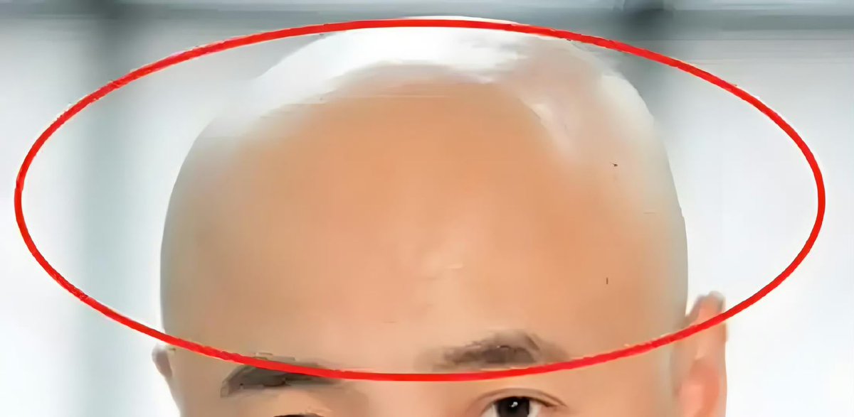 横竖的都可以称为伏犀骨，不过两侧的伏犀骨其实比横的更厉害，更容易成为达贵之人，横的更容易与达贵为伍，总之都非富即贵，但是一定要搭配好的耳朵，大耳垂长耳朵。占到这两样，其实眼神收起来用慈祥击败犀利。