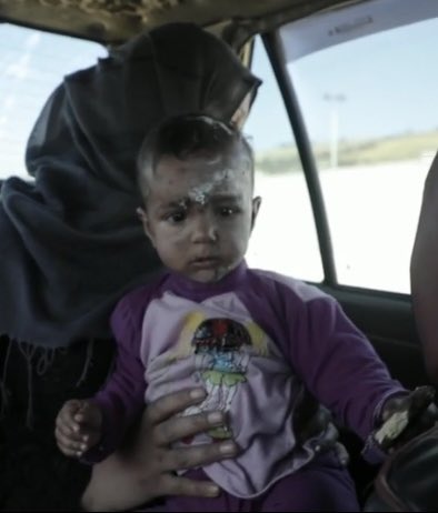 Paraic O'Brien (@paraicobrien) on Twitter photo Report on acts of war, airstrikes etc a lot but rarely get to revisit how one incident continues to affect one family, years on.
Team: <a href="/Zahra_ZW/">Zahra Warsame</a> @althomsonC4 <a href="/danny_makki/">Danny Makki</a> Report on acts of war, airstrikes etc a lot but rarely get to revisit how one incident continues to affect one family, years on.
Team: <a href="/Zahra_ZW/">Zahra Warsame</a> @althomsonC4 <a href="/danny_makki/">Danny Makki</a>
