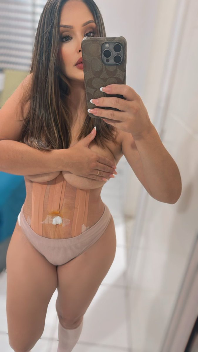 Aos poucos me recuperando...

Jaja tô boa