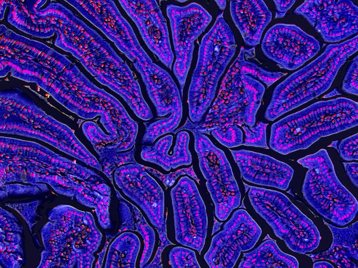 Centenary Institute (@centenaryinst) on Twitter photo FREE EVENT: Hybrid community event this Wednesday 26th March for 'Advances in Cancer Research: A Community Forum'. Research updates from our Centre for Cancer Innovations. Hosted by Centenary’s Dr <a href="/JessTiffen/">Dr Jessamy Tiffen</a>
Register: centenary.org.au/advances-in-ca… FREE EVENT: Hybrid community event this Wednesday 26th March for 'Advances in Cancer Research: A Community Forum'. Research updates from our Centre for Cancer Innovations. Hosted by Centenary’s Dr <a href="/JessTiffen/">Dr Jessamy Tiffen</a>
Register: centenary.org.au/advances-in-ca…