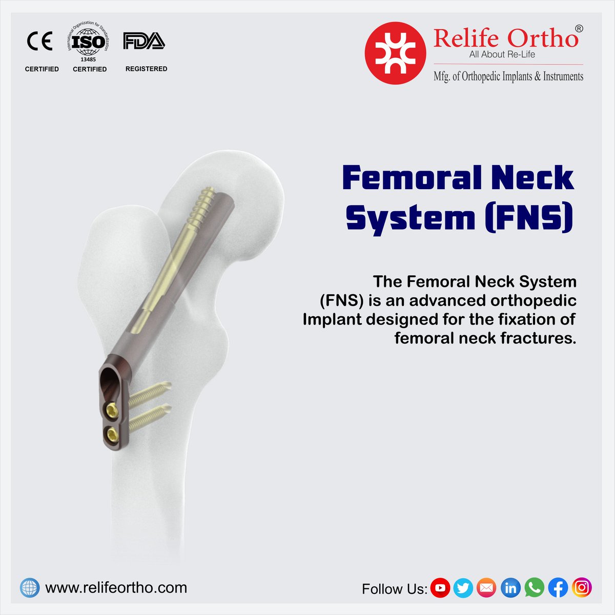 Relife_Ortho's tweet photo. "Advanced Stability for Faster Femoral Neck Fracture Healing!" 🚑💙

The Femoral Neck System (FNS) is an innovative orthopedic implant designed to provide enhanced fixation and stability for femoral neck fractures. https://t.co/LhHyBVHWga