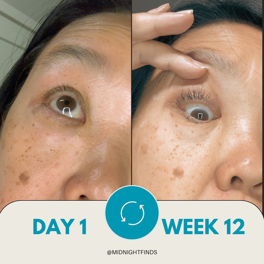 Nuorganic1's tweet photo. Another day another set of lash results 😍 https://t.co/mgVceKMVAI