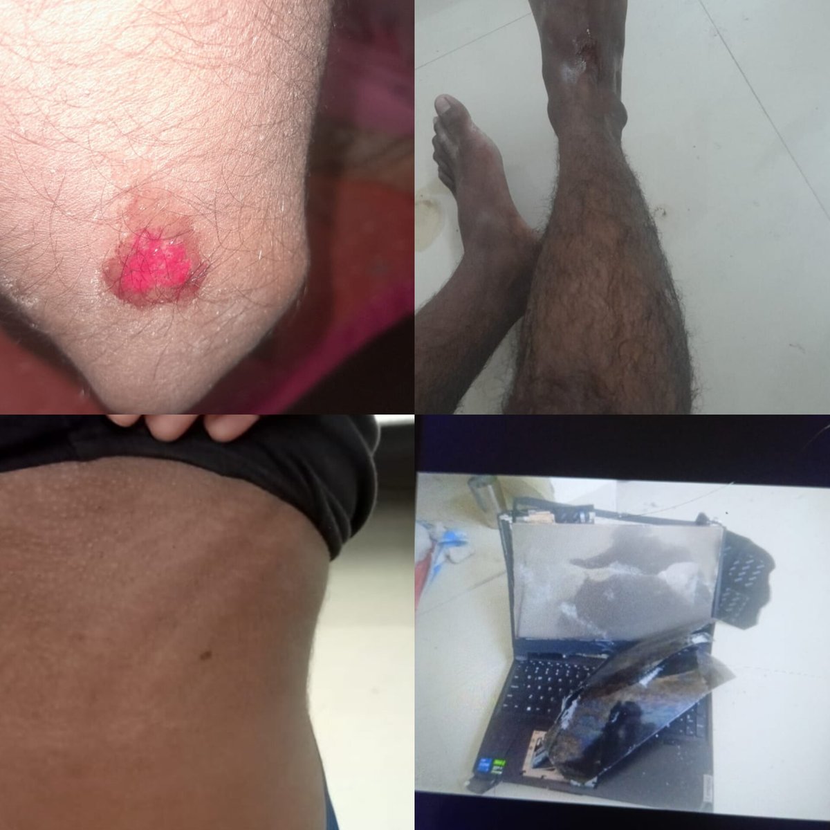 Gecsheoharstu's tweet photo. @helpline_BP @bihar_police @BiharEducation_ @beupatna @DSTTEBihar This is how you behave with students and victim Parents?? We want our students back wo got arrested https://t.co/5816vGUVF4