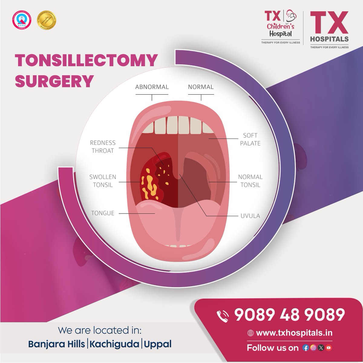 txhospitals's tweet photo. 🔹 Tonsillectomy Surgery at TX Hospitals! 🔹
Say goodbye to tonsil pain & throat infections with expert care!
📍 Banjara Hills | Kachiguda | Uppal
📞 9089 48 9089 | 🌐 https://t.co/tMhkjDModH
#TonsilSurgery #ENTCare #TXHospitals #HealthyThroat #Hyderabad https://t.co/tgIx9vVjQv