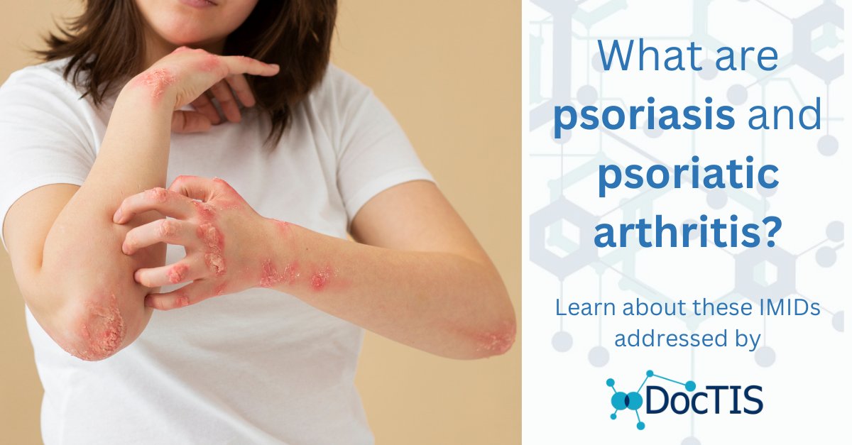DoctisEU's tweet image. 🧬 #Psoriasis and #PsoriaticArthritis are #IMIDs that impact quality of life, often coexisting in patients despite their different primary manifestations.

🔗 Learn about them &amp;amp; how the #DocTISProject aims to enhance treatment: doctis.eu/psoriasis-psor…

#AutoimmuneTherapies #IMID