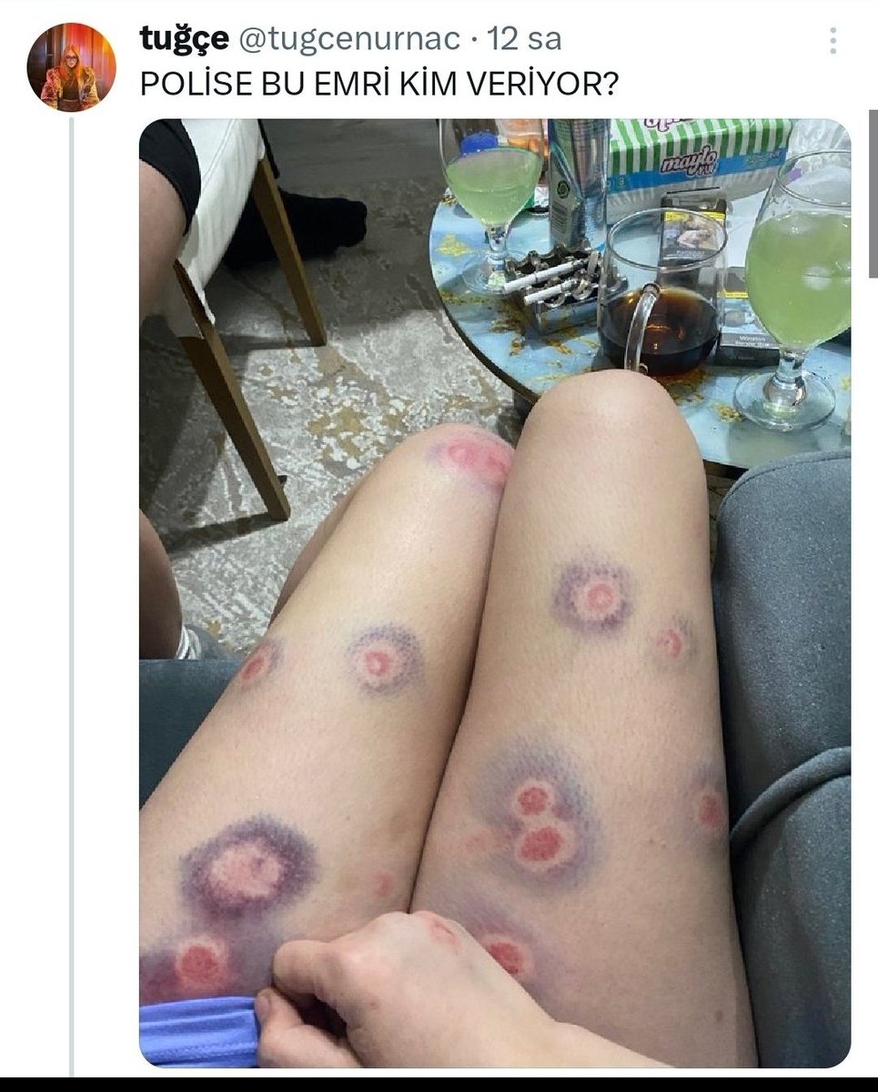 Kendini polisimize elletmeye
Giden bir chpkk lı kızcağız😁