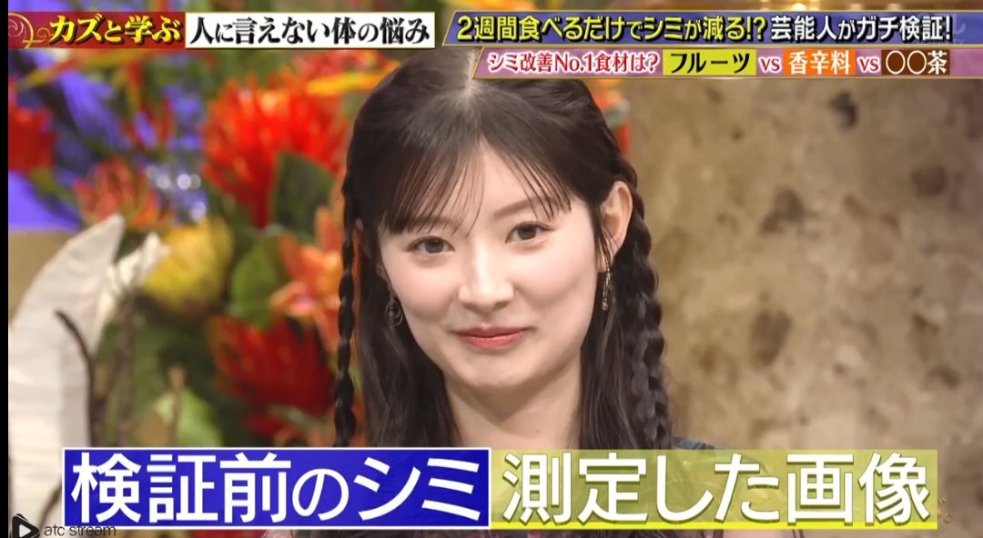 十夢のシミ検査の結果は 207個！ #カズレーザーと学ぶ #武藤十夢