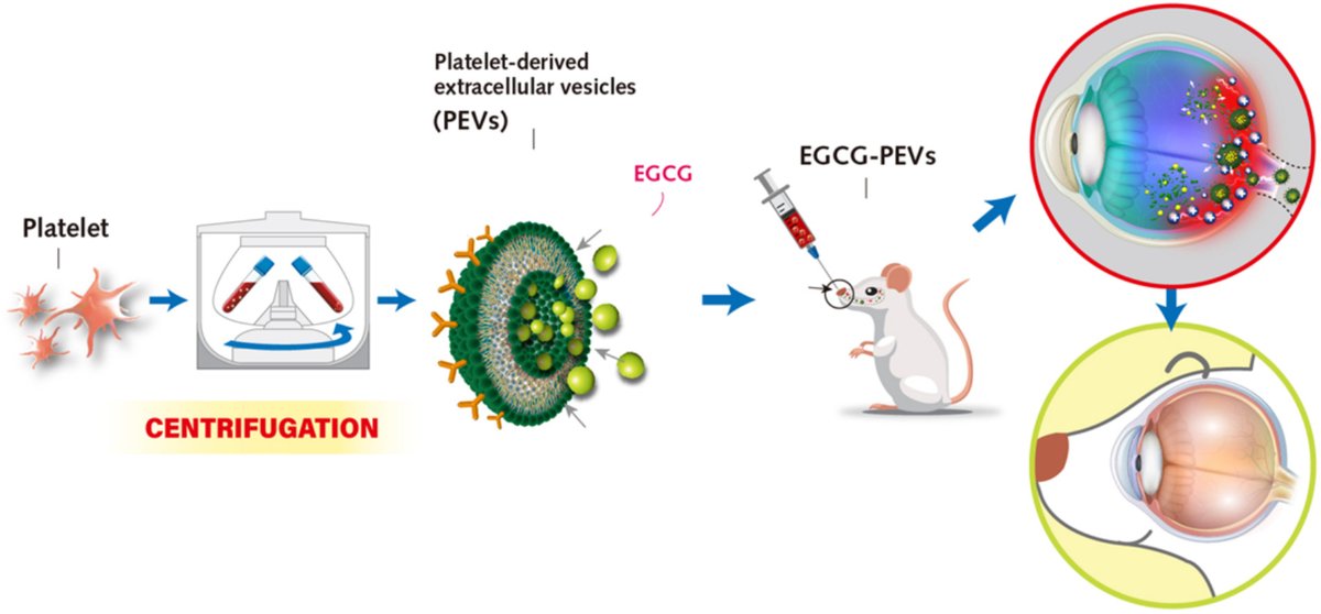 Intranasal delivery of epigallocatechin gallate-laden platelet extracellular vesicles for mitigating retinal glaucoma.
| Andrew E.-Y. Chuang <a href="/TaipeiMedicalU/">Taipei Medical University</a> | <a href="/CRS_TW_Local/">CRS Taiwan Local Chapter</a> 
[50 days' free access]
#Intranasal #ExtracellularVescile #glaucoma
kwnsfk27.r.eu-west-1.awstrack.me/L0/https:%2F%2…