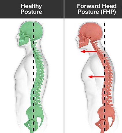 83% of desk workers have poor posture.

&amp; they have no idea just how much damage it’s causing...

It's destroying their:

• Spinal Health
• Mood regulation
• Breathing capacity

So here’s the complete guide to proper posture (&amp; how to fix yours in under 2 weeks):