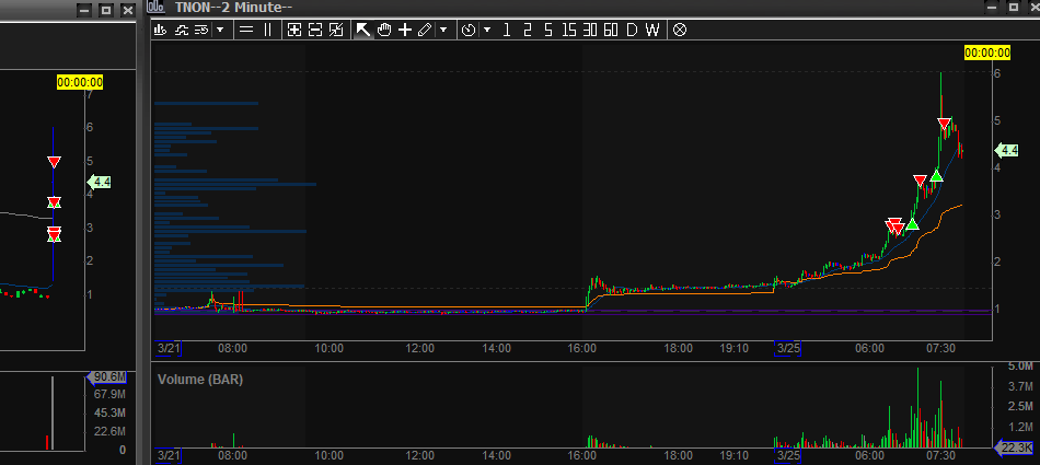 stonkstradercas's tweet photo. Got ya finalmente? $TNON

Hoy es el último día que opero gaps día 1, menos en PM. Después de $MLGO ayer y hoy esto, no tengo pq asumir estos riesgos, te despistas y te crujen. 

https://t.co/bZ8TBO8D0K https://t.co/e6261F8d5a