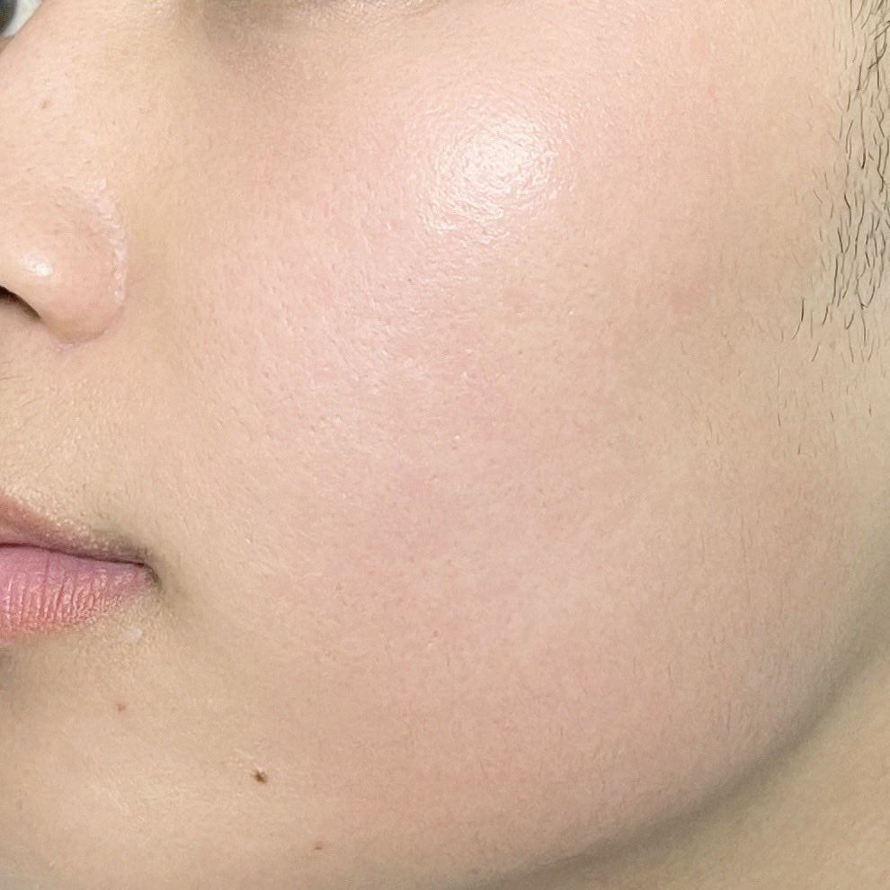 อยากบอกว่า น้ำตบ Eucerin ทำมาใหม่  
ทำถึงมากกก คือหน้าใสจริง ผิวชุ่มชื้น
แต่ไม่เหนอะ เค้าเพิ่มไทอามิดอล ดันความใสให้ผิว และลดจุดดำเก่งมาก แล้วอัดสารเก่งๆ อื่นมาครบมาก ผิวใส แข็งแรง รูขุนขนกระชับ และชุ่มชื้นขึ้นมาก https://t.co/HZgzGt6qAZ