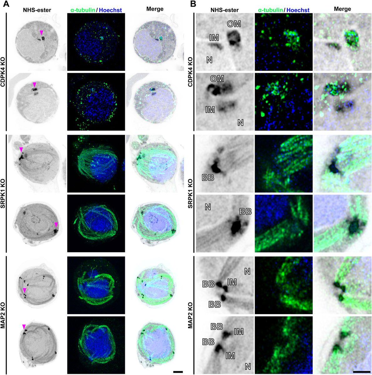 LifeScienceAlliance (@lsajournal) on Twitter photo This study reveals how Plasmodium kinases regulate MTOC, axoneme, and kinetochore organisation in male gametogenesis, providing key insights into potential targets for malaria transmission control <a href="/RitaTewari/">Rita Tewari</a> <a href="/RyujiYanase/">Ryuji Yanase</a> <a href="/Zeeshan_MF/">Zeeshan</a> <a href="/David_Guttery/">David Guttery</a>
hubs.la/Q03dh3ln0 This study reveals how Plasmodium kinases regulate MTOC, axoneme, and kinetochore organisation in male gametogenesis, providing key insights into potential targets for malaria transmission control <a href="/RitaTewari/">Rita Tewari</a> <a href="/RyujiYanase/">Ryuji Yanase</a> <a href="/Zeeshan_MF/">Zeeshan</a> <a href="/David_Guttery/">David Guttery</a>
hubs.la/Q03dh3ln0