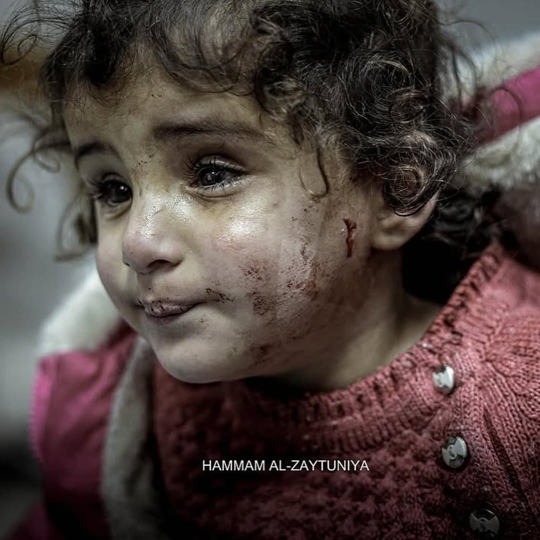 EyeonPalestine's tweet photo. The blind little girl Mayar Najjar (3) was in the Israeli air strike that targeted her home in Khan Younis. https://t.co/hgcrR5yUNU