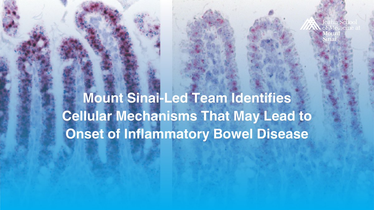 Mount Sinai Division of Gastroenterology (@mountsinaigi) on Twitter photo A research team led by Mount Sinai uncovered how abnormal #ImmuneCell function may trigger #CrohnsDisease, paving the way for new #Therapeutics to prevent inflammation before it starts. Learn more: bit.ly/4iGxY96
#Gastroenterology #MedicalResearch <a href="/DOMSinaiNYC/">Mount Sinai Department of Medicine</a> A research team led by Mount Sinai uncovered how abnormal #ImmuneCell function may trigger #CrohnsDisease, paving the way for new #Therapeutics to prevent inflammation before it starts. Learn more: bit.ly/4iGxY96
#Gastroenterology #MedicalResearch <a href="/DOMSinaiNYC/">Mount Sinai Department of Medicine</a>