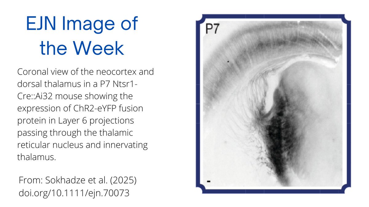 European Journal of Neuroscience (@ejneuroscience) on Twitter photo Check out the latest installment in our Image of the Week series!
From:
doi.org/10.1111/ejn.70…
<a href="/FENSorg/">FENS</a>
<a href="/WileyNeuro/">Wiley Neuro</a>
<a href="/ASNBUofL/">Anatomy Neurobiology Louisville Graduate Program</a> Check out the latest installment in our Image of the Week series!
From:
doi.org/10.1111/ejn.70…
<a href="/FENSorg/">FENS</a>
<a href="/WileyNeuro/">Wiley Neuro</a>
<a href="/ASNBUofL/">Anatomy Neurobiology Louisville Graduate Program</a>