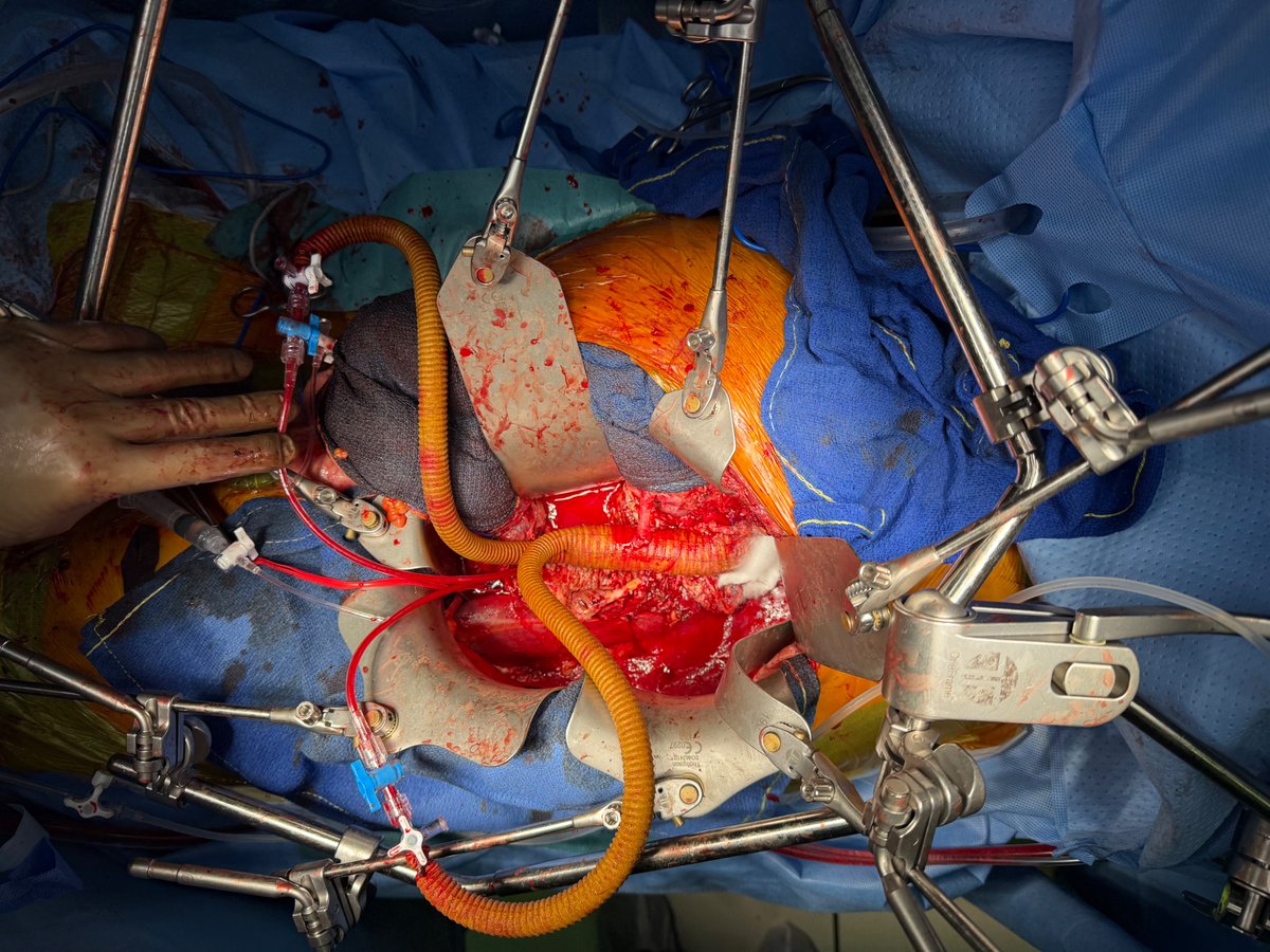 Xavier Berard tweet media