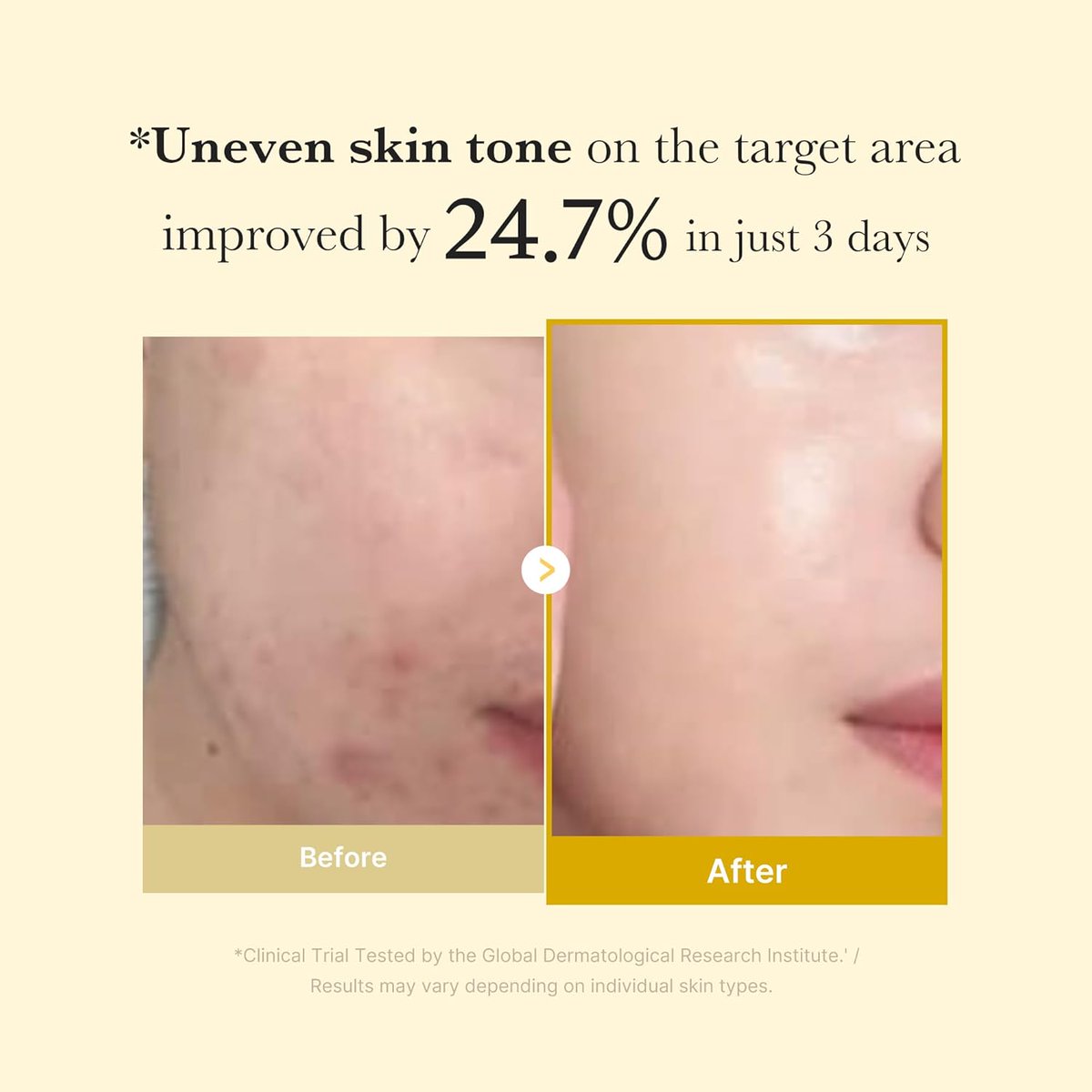 Medicube Turmeric Overnight Wrapping Peel Off Mask Product Link: amzn.to/422wU8fRead more: pin.it/4cidhHsUZ #skincare #mask #maskerwajah #skincareroutine #masker #beauty #covid #maskerorganik #masks #skincareproducts #facemaskmurah #maskerbubuk #facemask