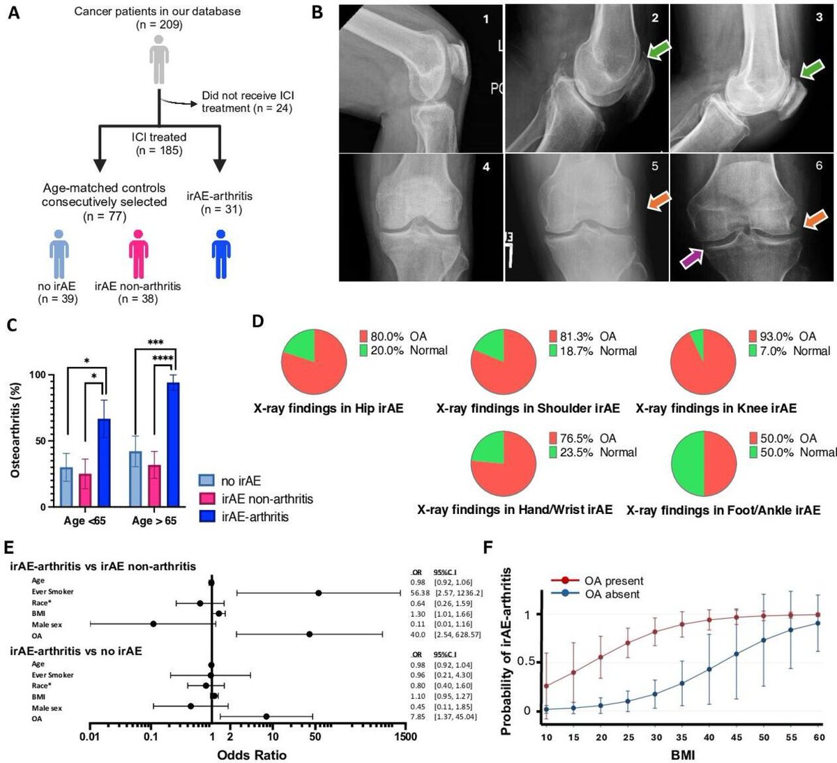 Journal for ImmunoTherapy of Cancer (@jitcancer) on Twitter photo New #JITC article: Osteoarthritis increases the risk of inflammatory arthritis due to immune checkpoint inhibitors associated with tissue-resident memory T cells bit.ly/4iBsqfZ <a href="/BHenickMD/">Brian Henick</a> @ColumbiaCancer New #JITC article: Osteoarthritis increases the risk of inflammatory arthritis due to immune checkpoint inhibitors associated with tissue-resident memory T cells bit.ly/4iBsqfZ <a href="/BHenickMD/">Brian Henick</a> @ColumbiaCancer