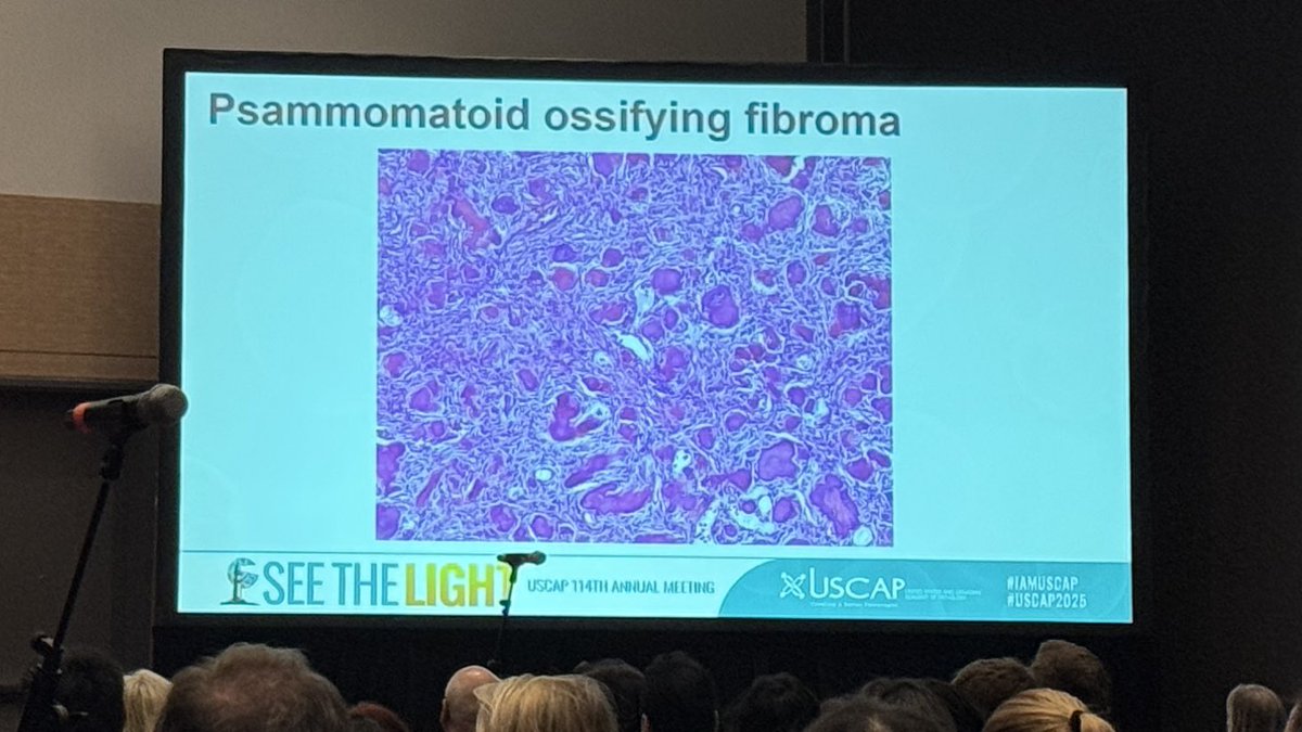 Nathalie Rodrigues Simoes, MD (@nathrodriguesmd) on Twitter photo If you couldn’t attend Dr. Kerr’s <a href="/darcykerrMD/">Darcy A. Kerr</a> lecture on fibro-osseous lesions of the craniofacial skeleton, check it out later with the on-demand option on the #USCAP25 website. Highly recommended! <a href="/DHPathRes/">Dartmouth Health Pathology Residency</a> If you couldn’t attend Dr. Kerr’s <a href="/darcykerrMD/">Darcy A. Kerr</a> lecture on fibro-osseous lesions of the craniofacial skeleton, check it out later with the on-demand option on the #USCAP25 website. Highly recommended! <a href="/DHPathRes/">Dartmouth Health Pathology Residency</a>