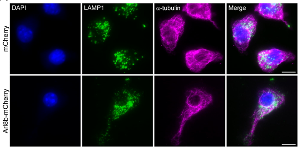 Waggoner Lab (@labwaggoner) on Twitter photo Lysosome positioning affects NLRP3 inflammasome activation <a href="/BillieJMatchett/">Billie Matchett</a>
doi.org/10.1101/2025.0… Lysosome positioning affects NLRP3 inflammasome activation <a href="/BillieJMatchett/">Billie Matchett</a>
doi.org/10.1101/2025.0…