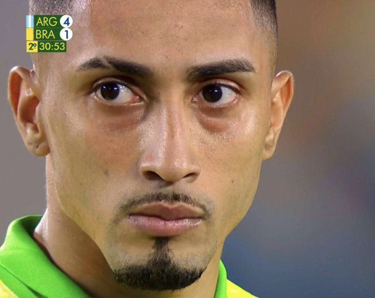 "Raphinha"

Porque dijo que le iban a dar una paliza a Argentina y no paró de tragar leche argentina en el estadio Monumental. Se volvió blanco de tanta leche derramada en la cara, no pararon de culearlo, se llevó la cogida de su vida el brazuca bocón hijo de re mil puta.