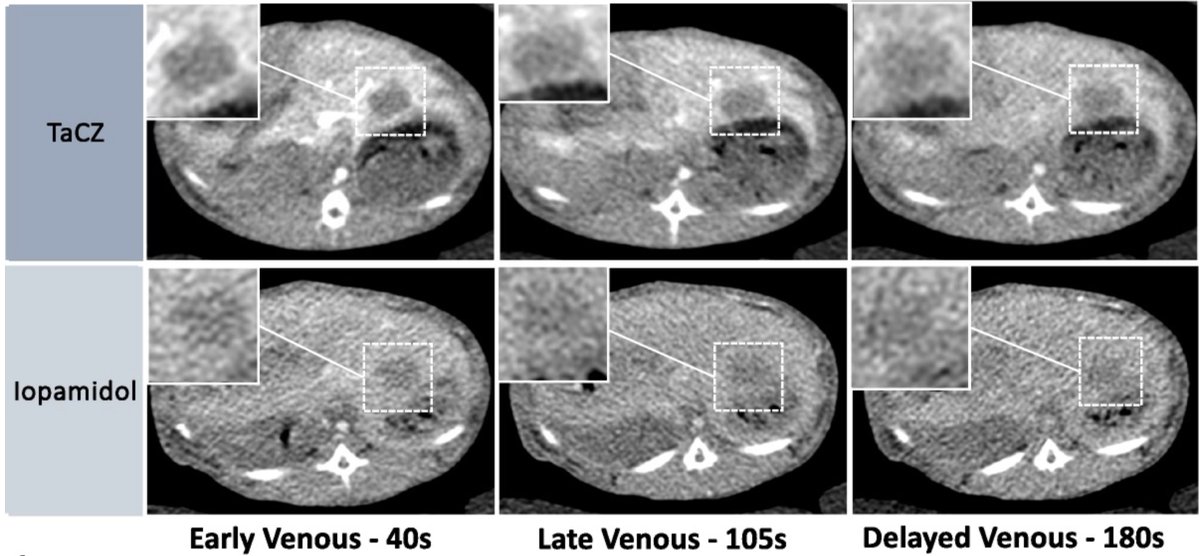 Heimer et al. demonstrate in a preclinical study that a #TantalumOxide–based nanoparticle #ContrastAgent showed higher hepatic contrast enhancement and improved the detection of #HepaticTumors in #ComputedTomography. <a href="/UCSFimaging/">UCSF Imaging</a> #LMUradiology

doi.org/10.1097/rli.00…