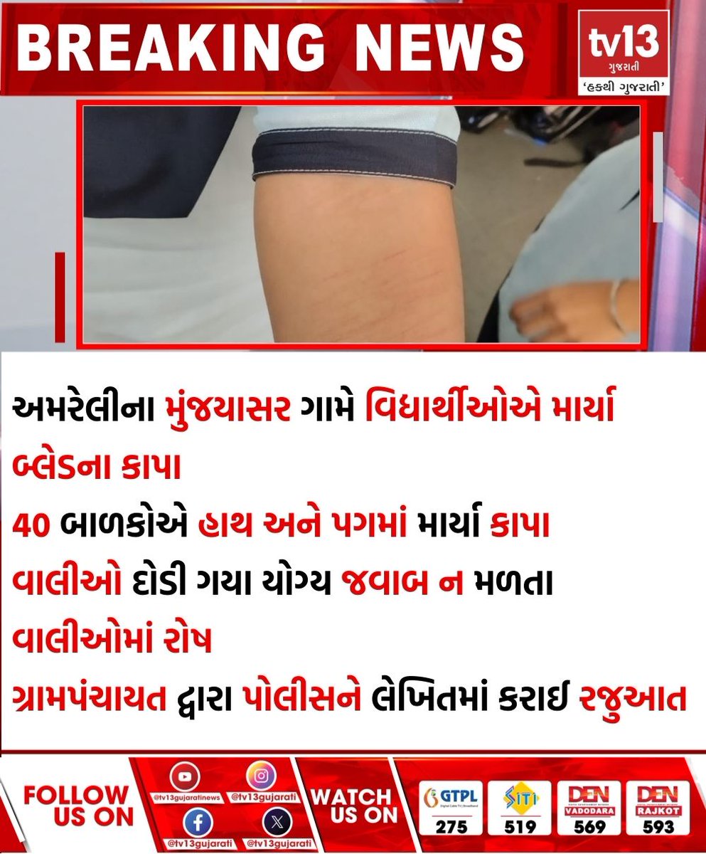 tv13gujarati's tweet photo. અમરેલીના મુંજયાસર ગામે વિદ્યાર્થીઓએ માર્યા બ્લેડના કાપા
#amreli #munjyasar #Village #Students #blade #attact #tv13gujarati https://t.co/YresuiCetU