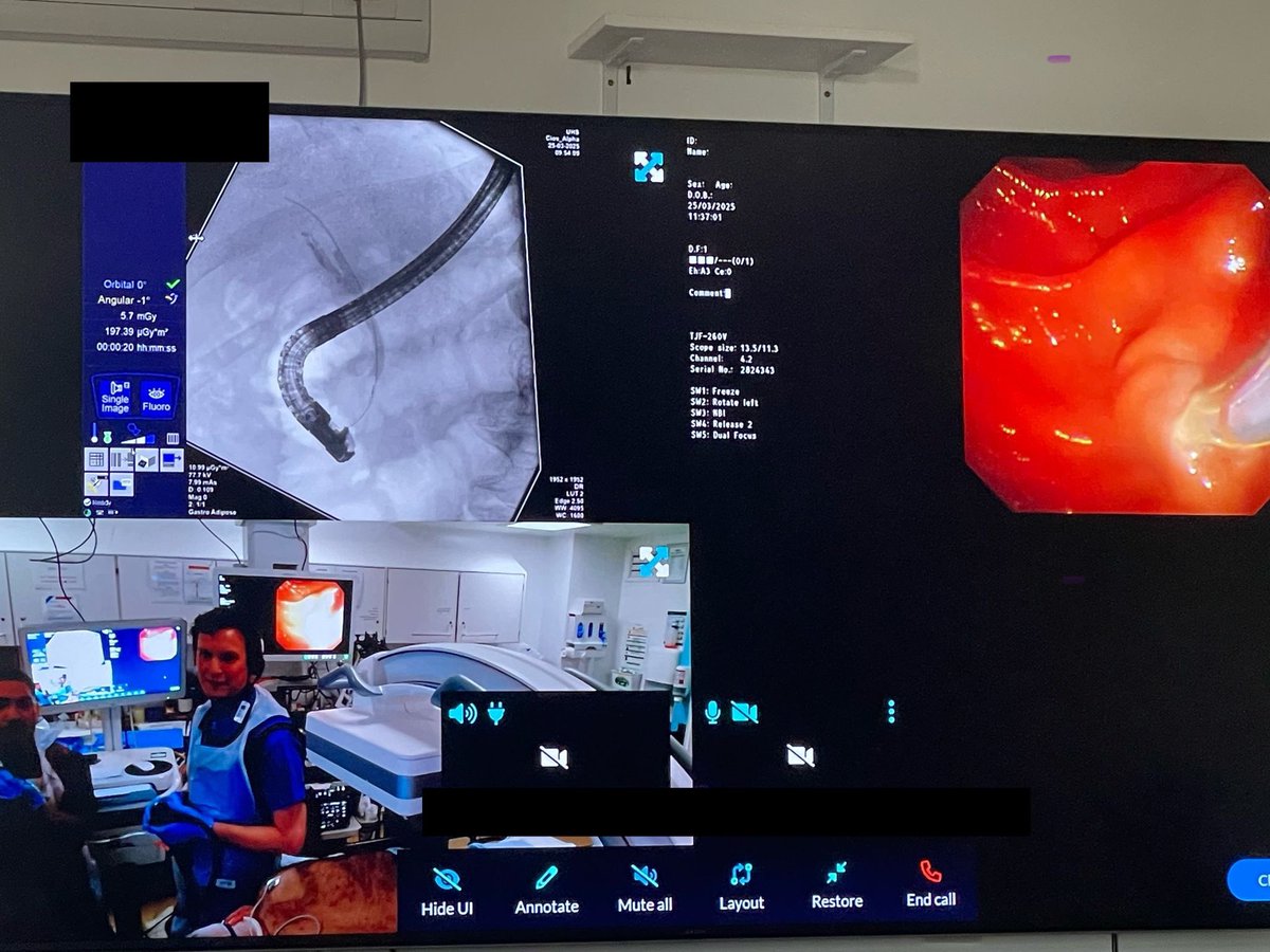 Successfully wrapped up the ERCP Best Practice Course with live endoscopy cases!

We covered

✅ Difficult cannulation

✅ Intrahepatic duct stone management

✅ Recurrent calculus cholecystitis &amp; cholangitis with duct clearance &amp; GBD

Outstanding teamwork by everyone involved 🙏