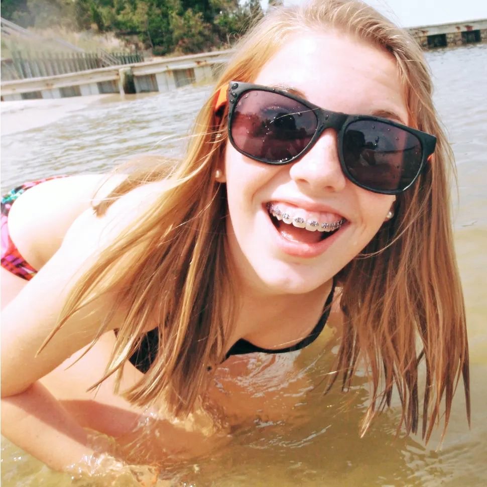 BraceFHeadcase's tweet photo. #artisticallgorgeous
#bracesarebeautiful
#orallygifted
#orallyordained
#metalmouth
#gorgeousfaces
#Girlswithbraces
#ilovebraces 
#girlsfaces
#artisticallybeautiful
#artisticallyperfect
#beyondbeautiful
💕💞💗🩷💗💞💕 https://t.co/y7SlcYCVHg