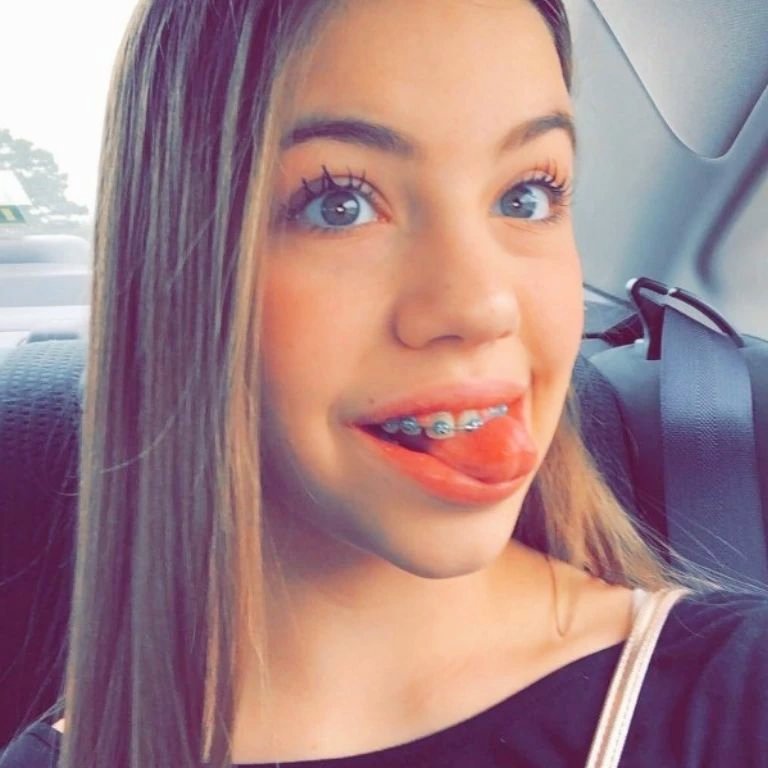 BraceFHeadcase's tweet photo. #artisticallgorgeous
#bracesarebeautiful
#orallygifted
#orallyordained
#metalmouth
#gorgeousfaces
#Girlswithbraces
#ilovebraces 
#girlsfaces
#artisticallybeautiful
#artisticallyperfect
#beyondbeautiful
💕💞💗🩷💗💞💕 https://t.co/y7SlcYCVHg