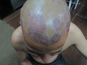 Diagnosis?  Answer: buff.ly/6mELUtV