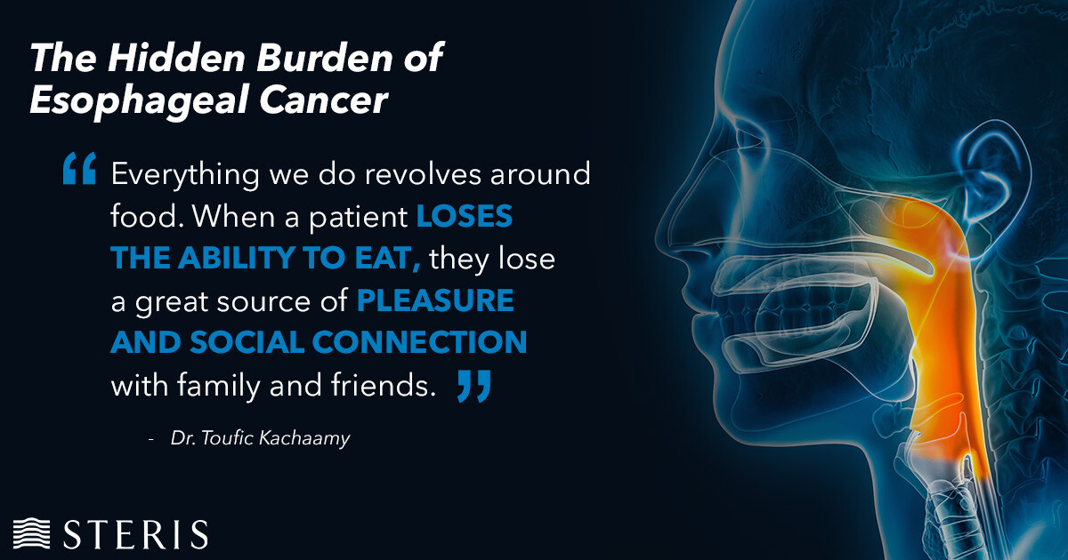 STERIS Endoscopy (@sterisendoscopy) on Twitter photo Esophageal cancer can drastically impact a patient's quality of life, making even the simplest acts of eating and drinking a daily challenge. Dysphagia, or difficulty swallowing, affects not just the ability to consume food, but also liquids, turning every meal into a struggle. Esophageal cancer can drastically impact a patient's quality of life, making even the simplest acts of eating and drinking a daily challenge. Dysphagia, or difficulty swallowing, affects not just the ability to consume food, but also liquids, turning every meal into a struggle.