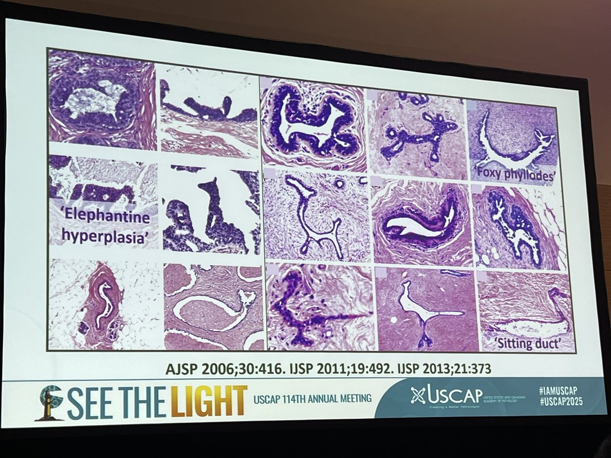Great session by Dr Hoda. Foxy phyllodes #USCAP2025
