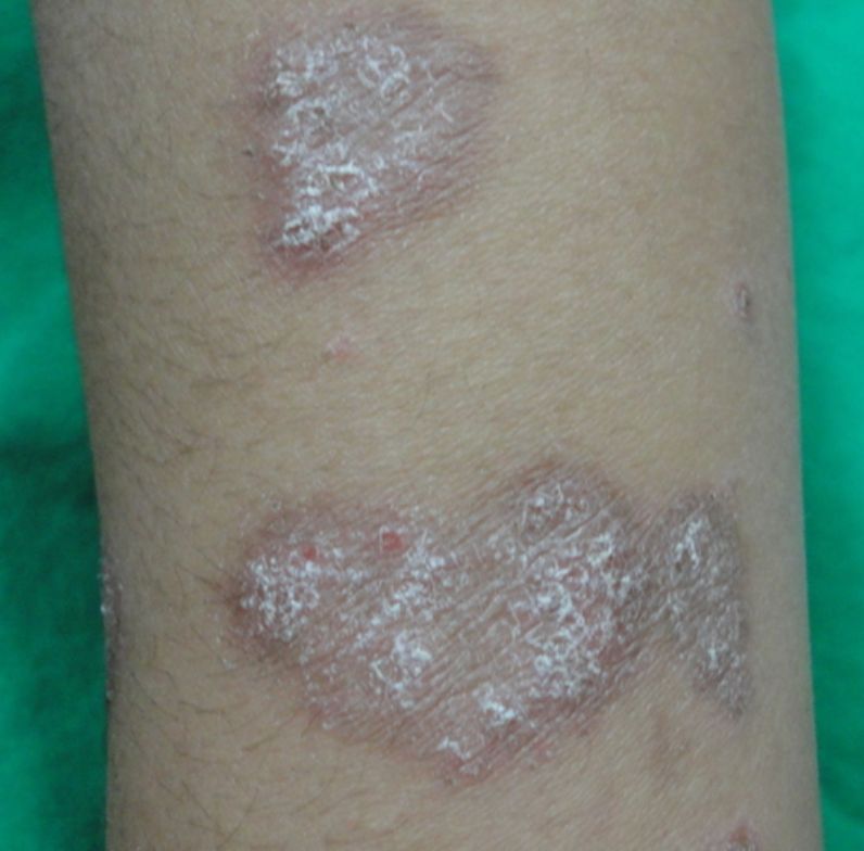 Diagnosis?  Answer = buff.ly/t8FOPcX