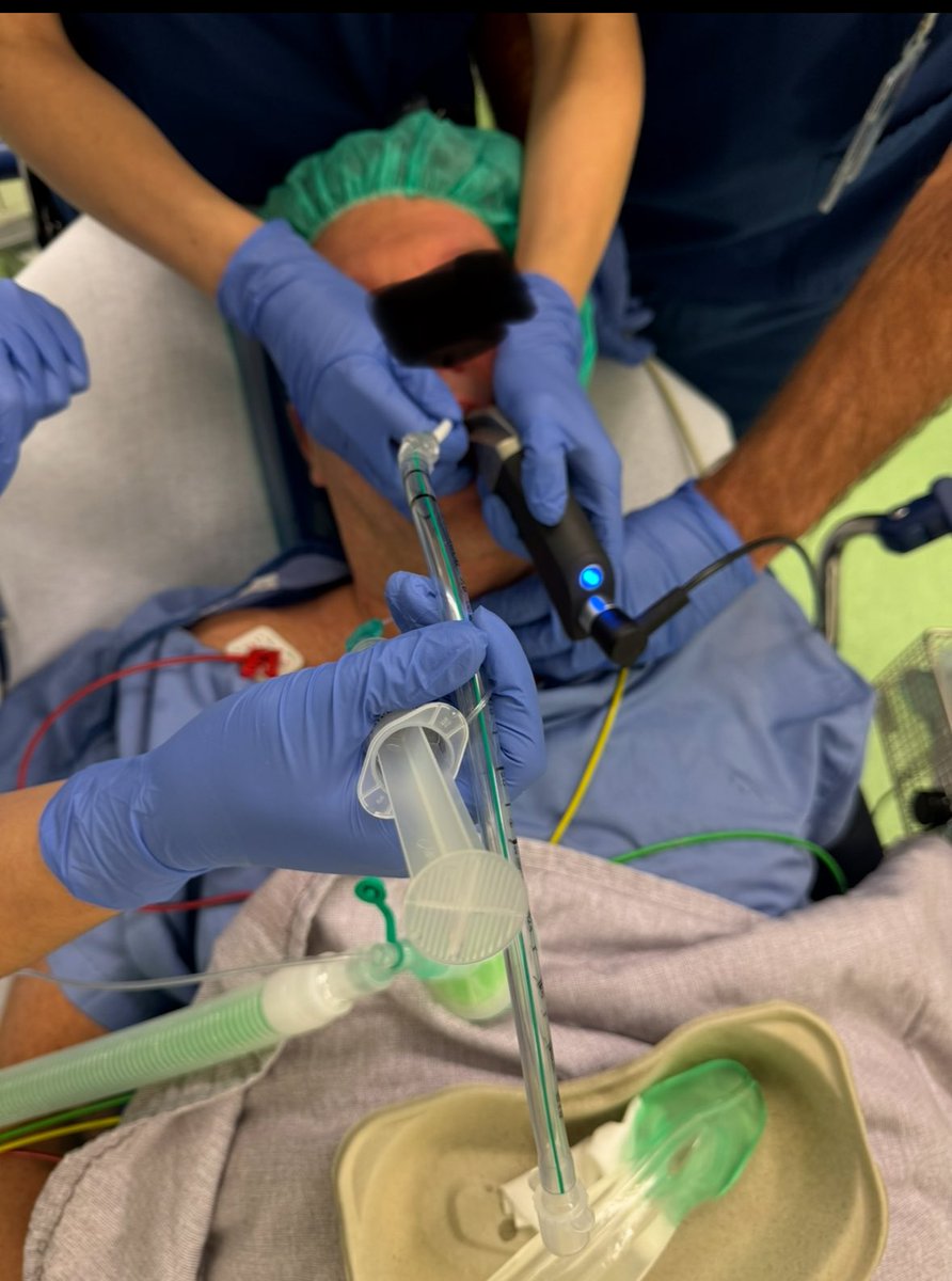 💡 Advanced airway management technique.

Patient 66 years, acute neurosurgical procedure in prone position. 

Airway Triage: advanced airway with high complexity due to high BMI and hoarse voice. <a href="/AirwayTriageApp/">Airway Triage App</a> 

During intubation: 

1️⃣abnormal distorted airway anatomy and
