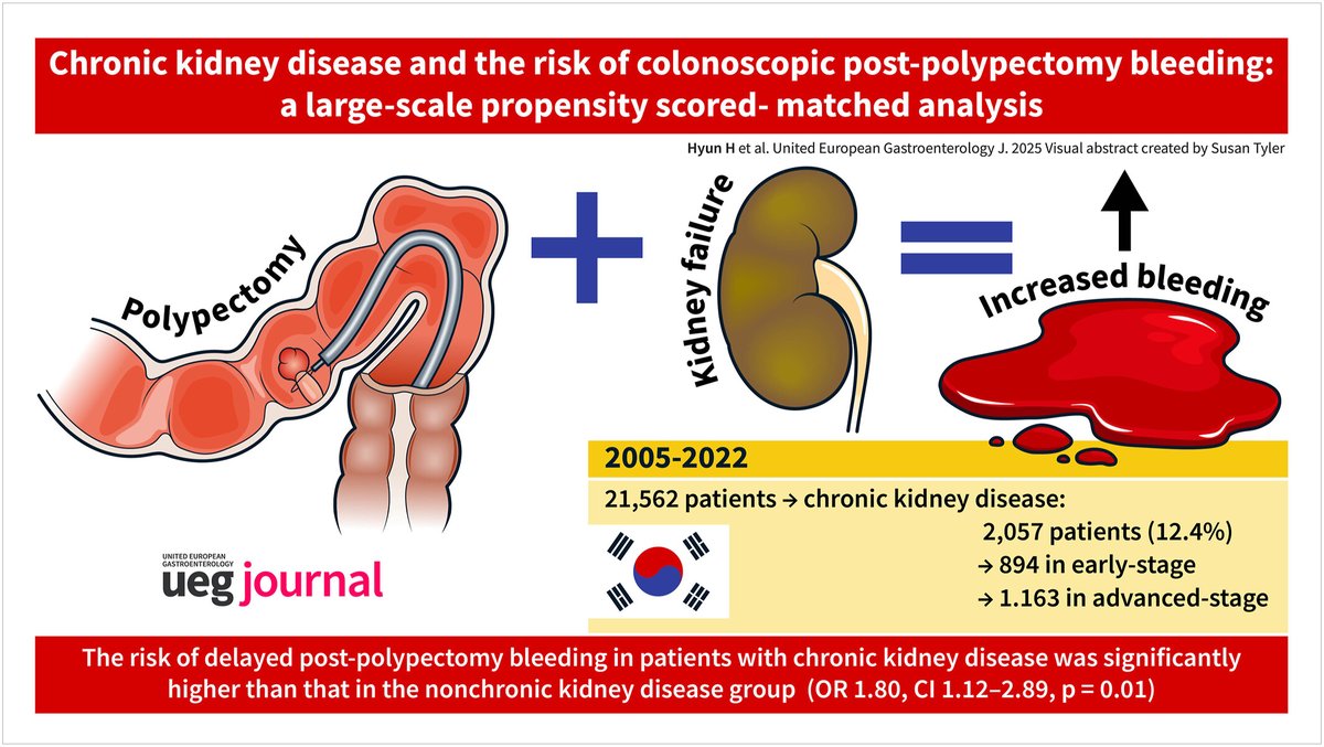 🚨 Patients with chronic kidney disease (CKD) are at a ⬆️ risk of bleeding 🩸 after polypectomy 🔪,  📊 the risk is associated to all CKD stages. 

🏥 Close 👀 for at least 1 month post-polypectomy is crucial.

🔗 tinyurl.com/2p9jr88t

<a href="/my_ueg/">my_UEG</a> 
<a href="/ESGE_news/">ESGE</a>
<a href="/drkeithsiau/">Keith Siau</a>