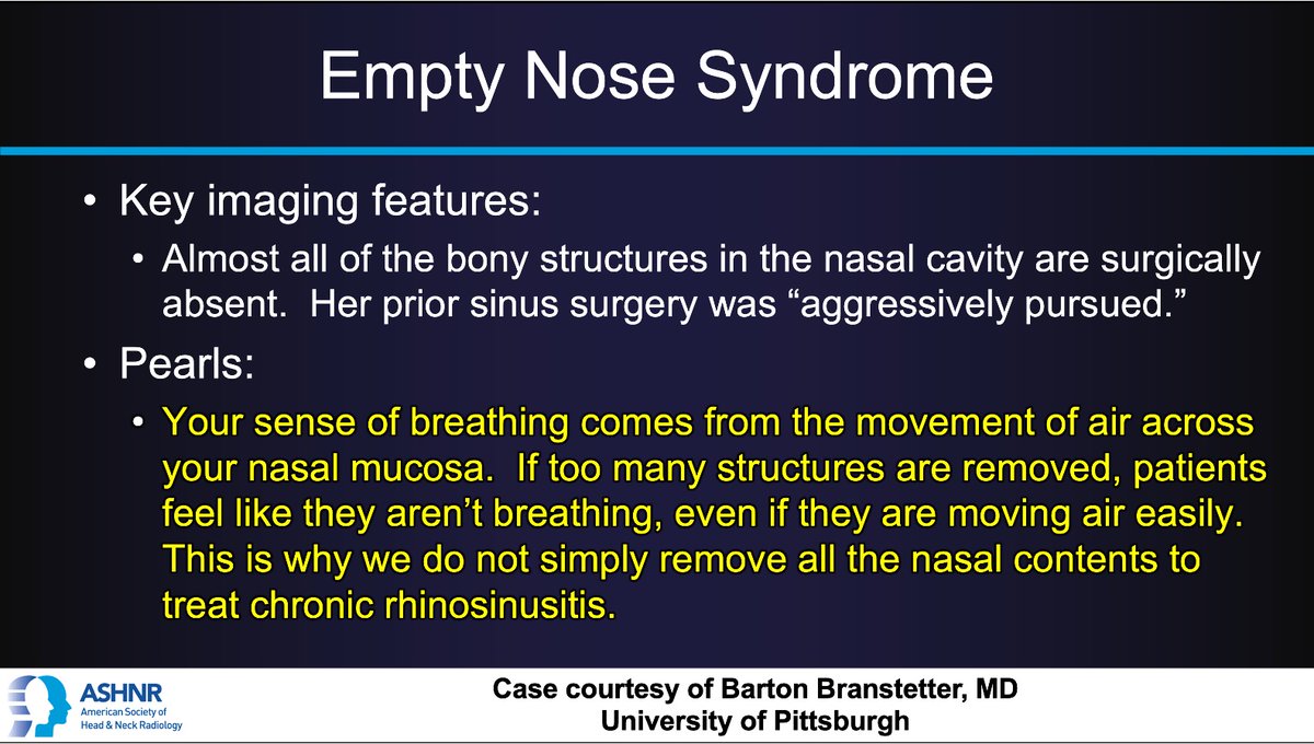 ASHNR (@ashnrsociety) on Twitter photo #ASHNRCOTW #289: ANSWER. Thx Dr.
<a href="/CharBranstetter/">Char Branstetter</a> 4 case! #ASHNR25
<a href="/callyrobs/">Caroline Robson, MBChB</a> <a href="/DShatzkes/">Deborah Shatzkes</a> <a href="/CDP_Rad/">C Douglas Phillips 🇺🇸</a> <a href="/rhwiggins/">Richard Wiggins</a>
<a href="/nakoontz/">Nicholas Koontz</a> <a href="/KRileyMD/">Kalen Riley</a> <a href="/CMGlastonbury/">Christine M Glastonbury, MD</a> <a href="/tabby_kennedy/">Tabby A. Kennedy, MD</a> @PhilipRChapman
<a href="/cmtomblinson/">Courtney Tomblinson, MD</a> <a href="/amyfjuliano/">Amy Juliano</a>
<a href="/bpoliceni/">Bruno Policeni</a> <a href="/MohitTCCNeuro/">Mohit Agarwal</a> <a href="/AshokSrini15/">Ashok Srinivasan</a>
<a href="/KatieTraylorDO/">Katie S. Traylor MS, DO, DABR</a> <a href="/CynXinWu/">Cynthia Xin Wu</a> #ASHNRCOTW #289: ANSWER. Thx Dr.
<a href="/CharBranstetter/">Char Branstetter</a> 4 case! #ASHNR25
<a href="/callyrobs/">Caroline Robson, MBChB</a> <a href="/DShatzkes/">Deborah Shatzkes</a> <a href="/CDP_Rad/">C Douglas Phillips 🇺🇸</a> <a href="/rhwiggins/">Richard Wiggins</a>
<a href="/nakoontz/">Nicholas Koontz</a> <a href="/KRileyMD/">Kalen Riley</a> <a href="/CMGlastonbury/">Christine M Glastonbury, MD</a> <a href="/tabby_kennedy/">Tabby A. Kennedy, MD</a> @PhilipRChapman
<a href="/cmtomblinson/">Courtney Tomblinson, MD</a> <a href="/amyfjuliano/">Amy Juliano</a>
<a href="/bpoliceni/">Bruno Policeni</a> <a href="/MohitTCCNeuro/">Mohit Agarwal</a> <a href="/AshokSrini15/">Ashok Srinivasan</a>
<a href="/KatieTraylorDO/">Katie S. Traylor MS, DO, DABR</a> <a href="/CynXinWu/">Cynthia Xin Wu</a>